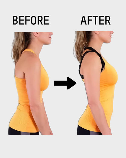 💖 🚗Delivered within five working days🔥⚡ Front-fastening criss-cross strap, wire-free posture-correcting bra ✨